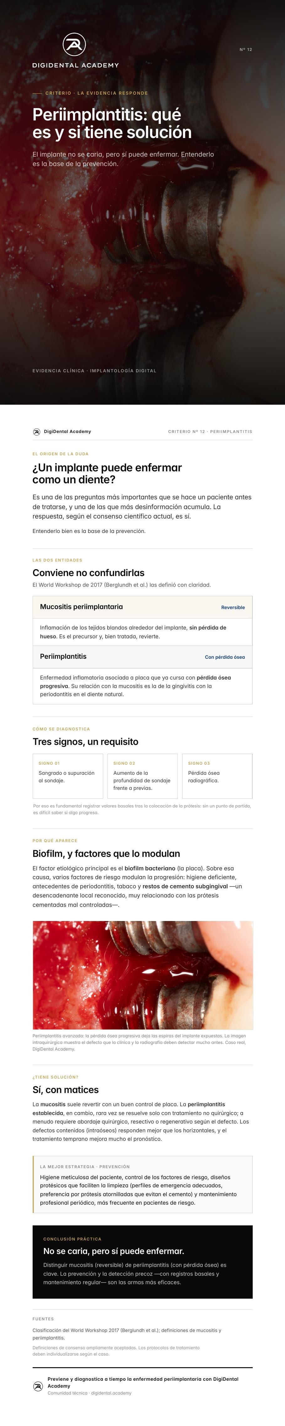 Vista previa de Periimplantitis: qué es y si tiene solución
