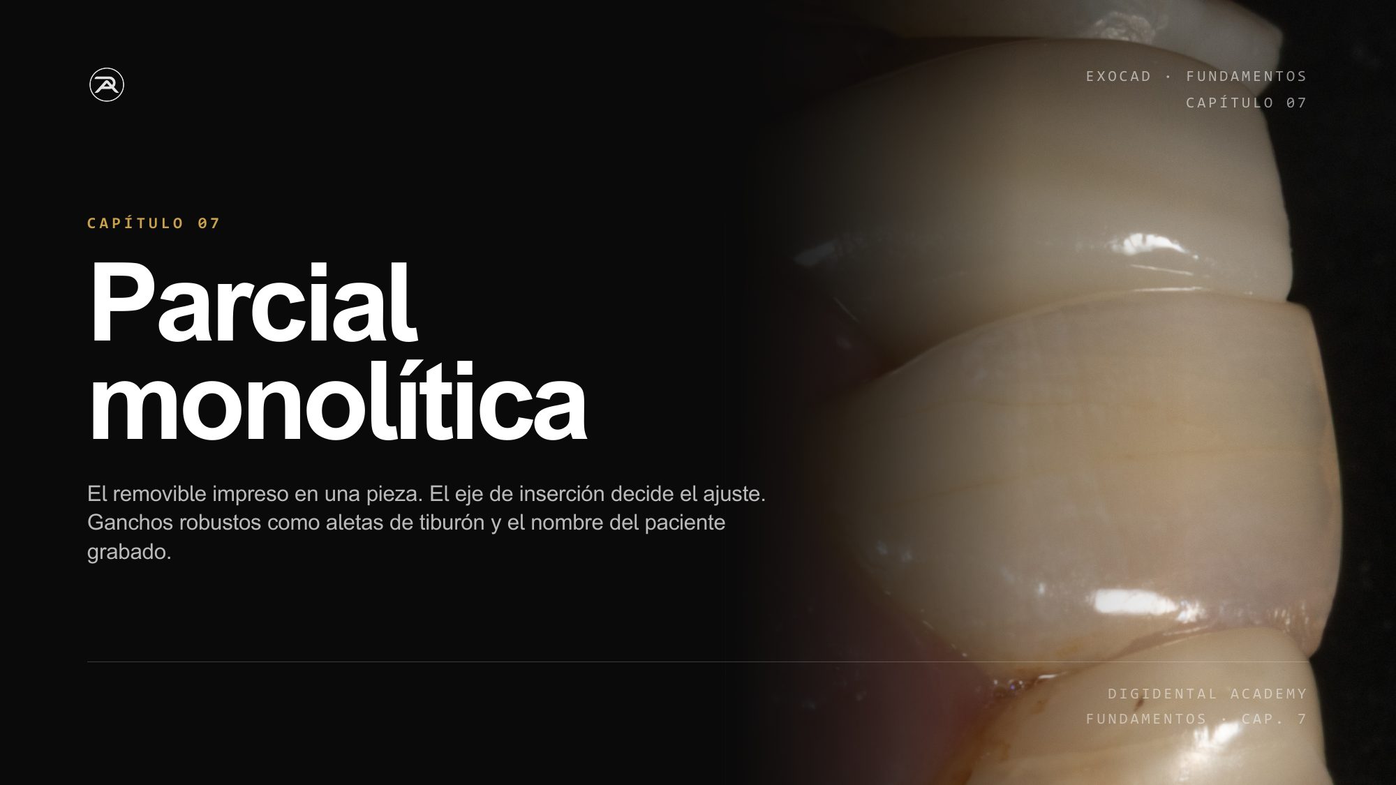 Cap. 7 · Removible monolítica