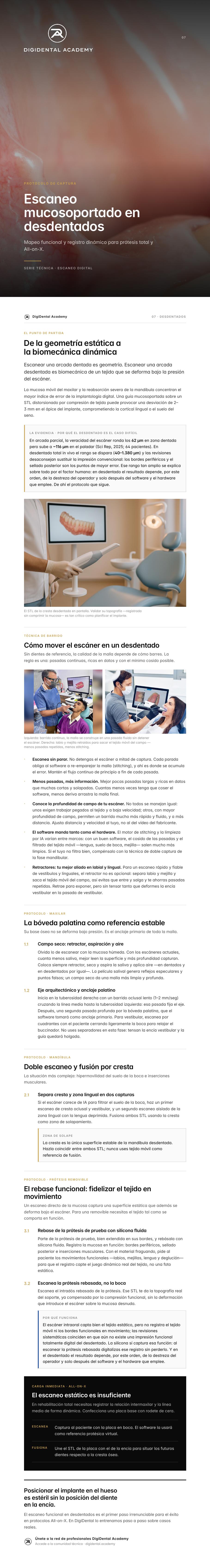 Vista previa de Claves para el escaneo en pacientes desdentados
