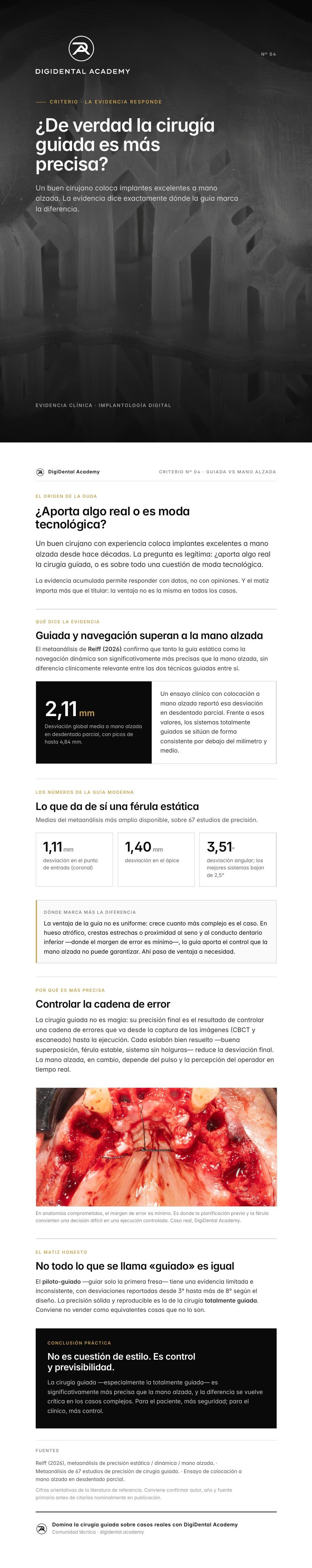 Vista previa de ¿De verdad la cirugía guiada es más precisa?