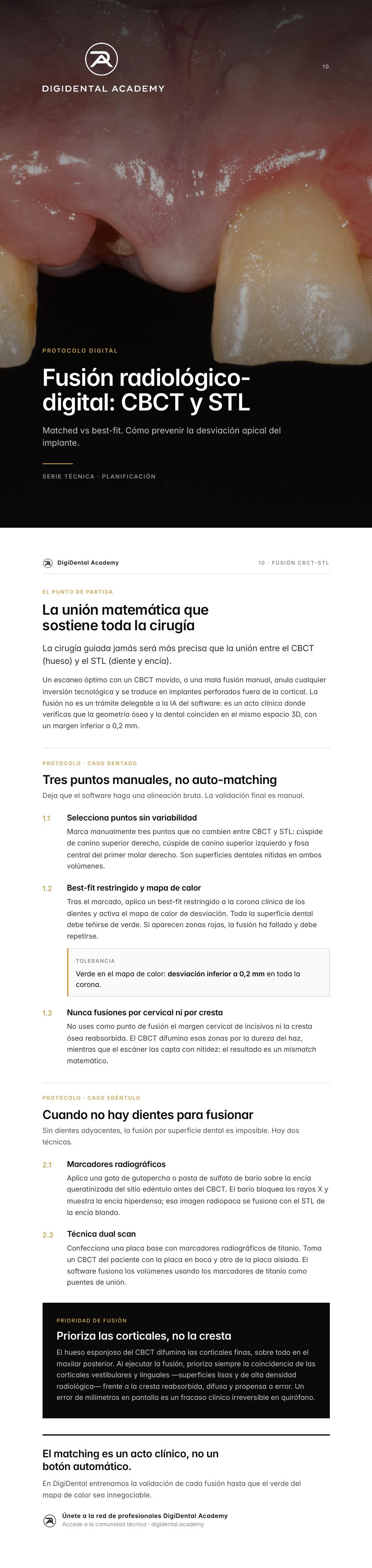 Vista previa de Fusión radiológica digital: CBCT y STL