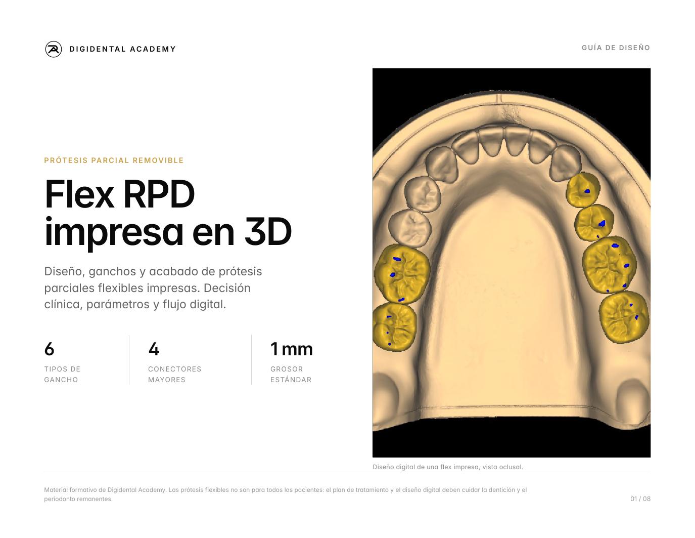 Prótesis Flex impresas en 3D