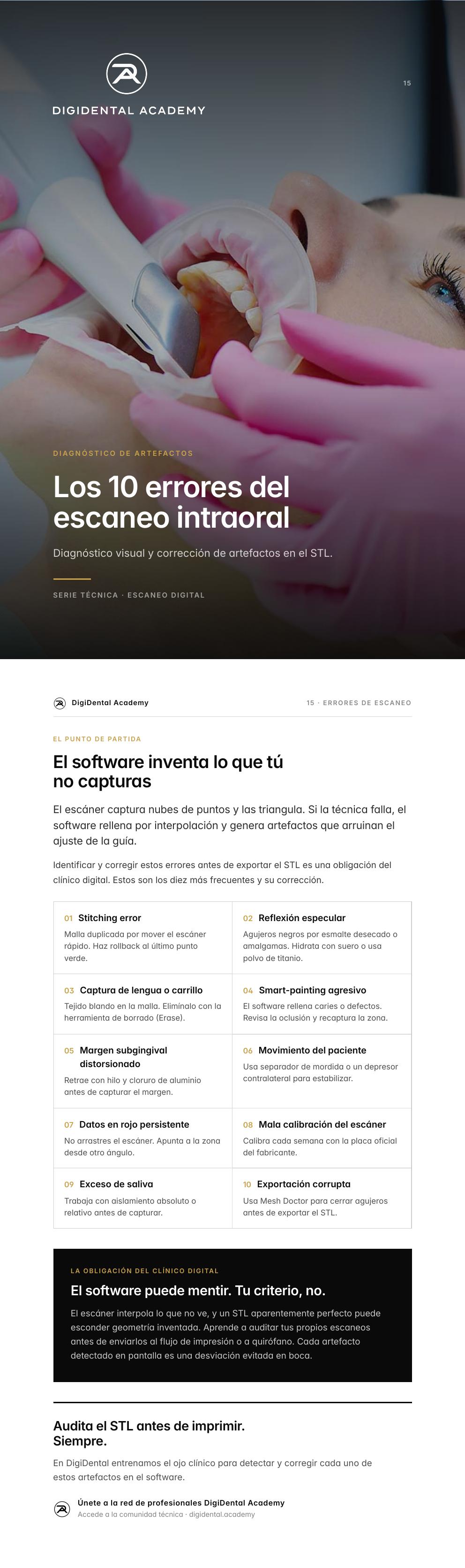 Vista previa de 10 errores del escaneo intraoral